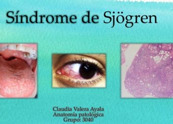 [VIDEO] Científicos chilenos investigan extraña enfermedad que afecta a mujeres