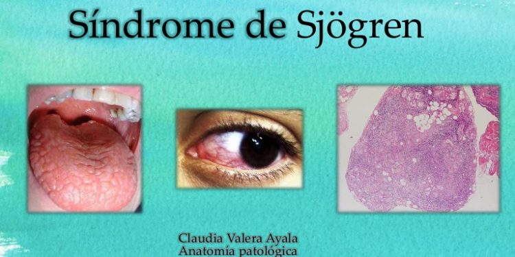 [VIDEO] Científicos chilenos investigan extraña enfermedad que afecta a mujeres